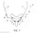 Fig. 08 - Headgear for patient interface
