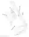 Fig. 06 - Adaptable sleeve for catheter securement and protection