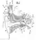 Fig. 02 - Universal implant