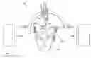 Fig. 01 - Systems and method for deep brain stimulation therapy