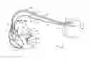 Fig. 01 - APPARATUS AND METHODS OF OPTIMIZING ATRIOVENTRICULAR PACING DELAY INTERVALS