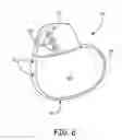Fig. 07 - APPARATUS AND METHODS OF OPTIMIZING ATRIOVENTRICULAR PACING DELAY INTERVALS