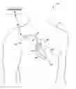 Fig. 01 - Determination of hemodynamic intolerance of ventricular pacing