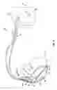 Fig. 03 - Determination of hemodynamic intolerance of ventricular pacing
