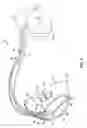 Fig. 04 - Determination of hemodynamic intolerance of ventricular pacing