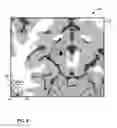 Fig. 09 - User interface with 3D environment for configuring stimulation therapy