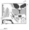 Fig. 10 - User interface with 3D environment for configuring stimulation therapy