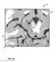 Fig. 11 - User interface with 3D environment for configuring stimulation therapy