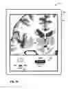 Fig. 20 - User interface with 3D environment for configuring stimulation therapy