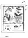 Fig. 24 - User interface with 3D environment for configuring stimulation therapy
