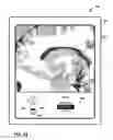 Fig. 25 - User interface with 3D environment for configuring stimulation therapy