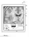 Fig. 40 - User interface with 3D environment for configuring stimulation therapy