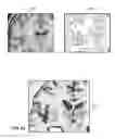 Fig. 44 - User interface with 3D environment for configuring stimulation therapy