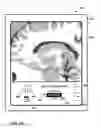 Fig. 55 - User interface with 3D environment for configuring stimulation therapy