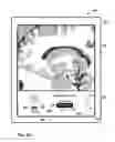 Fig. 60 - User interface with 3D environment for configuring stimulation therapy