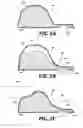 Fig. 05 - Pressure resistant conductive fluid containment