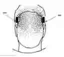 Fig. 01 - Magnetic Therapeutic Device and Methods of Using the Same