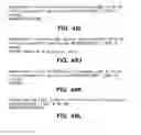 Fig. 45 - SYSTEM AND METHOD FOR THERAPEUTIC MANAGEMENT OF COUGH