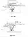 Fig. 67 - SYSTEM AND METHOD FOR THERAPEUTIC MANAGEMENT OF COUGH