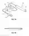 Fig. 03 - METHODS AND APPARATUSES FOR TREATING GLAND DYSFUNCTION EMPLOYING HEATED MEDIUM