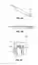 Fig. 04 - METHODS AND APPARATUSES FOR TREATING GLAND DYSFUNCTION EMPLOYING HEATED MEDIUM
