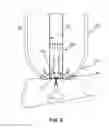 Fig. 05 - METHODS AND APPARATUSES FOR TREATING GLAND DYSFUNCTION EMPLOYING HEATED MEDIUM