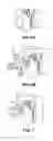 Fig. 06 - METHODS AND APPARATUSES FOR TREATING GLAND DYSFUNCTION EMPLOYING HEATED MEDIUM
