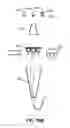 Fig. 10 - METHODS AND APPARATUSES FOR TREATING GLAND DYSFUNCTION EMPLOYING HEATED MEDIUM