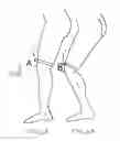 Fig. 07 - Golf backswing training aid and alert