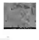 Fig. 06 - Method for producing metal microparticles