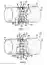 Fig. 02 - Vehicle exhaust assembly
