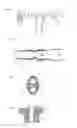 Fig. 03 - Crossmember Arrangement and Method for Production