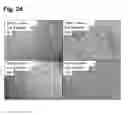 Fig. 27 - Peptides that stimulate subcutaneous adipogenesis