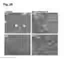 Fig. 29 - Peptides that stimulate subcutaneous adipogenesis