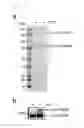 Fig. 22 - Method for crystallization of TRX-TXNIP complex mutein and 3D structure thereof