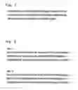Fig. 02 - Glyco-engineered antibodies