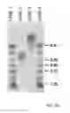 Fig. 52 - Method of modifying isoelectric point of antibody via amino acid substitution in CDR