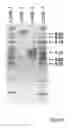 Fig. 53 - Method of modifying isoelectric point of antibody via amino acid substitution in CDR