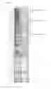Fig. 32 - ncRNA AND USES THEREOF
