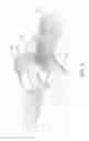 Fig. 09 - Methods for making zoned apertured webs