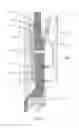 Fig. 04 - Weak link for a riser system