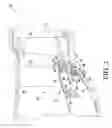 Fig. 03 - Vane ring for a turbine engine having retention devices