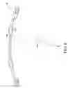 Fig. 06 - Vane ring for a turbine engine having retention devices