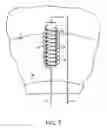 Fig. 09 - Apparatus and methods for recovery of variational wind energy