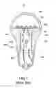 Fig. 02 - Illuminant device