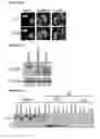 Fig. 02 - iASPP phosphorylation and metastatic potential