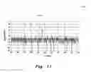 Fig. 09 - Enhanced dynamic range RF pulse measurement system