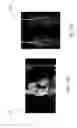 Fig. 07 - Methods and systems for acquiring multiple interleaved slices in magnetic resonance imaging