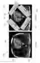 Fig. 08 - Methods and systems for acquiring multiple interleaved slices in magnetic resonance imaging