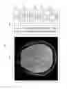 Fig. 06 - Method and apparatus for adjusting the parameters of a magnetic resonance image